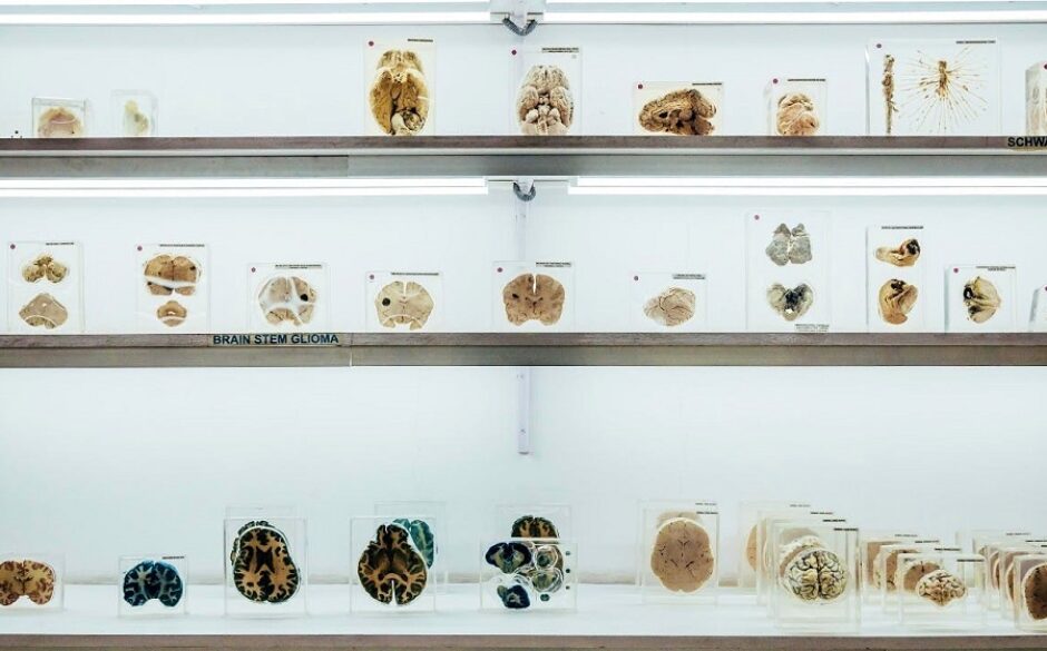Exhibits of brains of all sizes at the Human Brain Museum, Kolkata